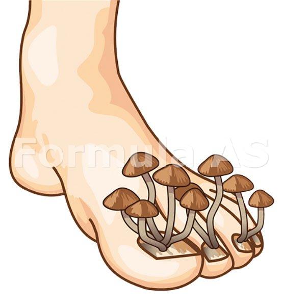 fracțiunea 3 din ciuperca unghiilor de la picioare