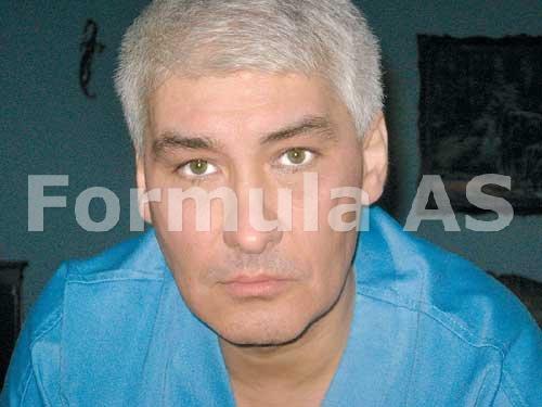 varici decât ameninarea ce sa visezi varicoza